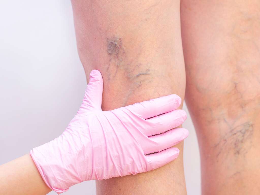 slides tv (Apresentação (43)) (1)