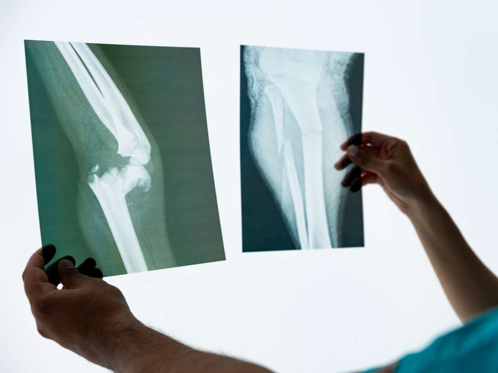 slides tv (Apresentação (43)) (17)