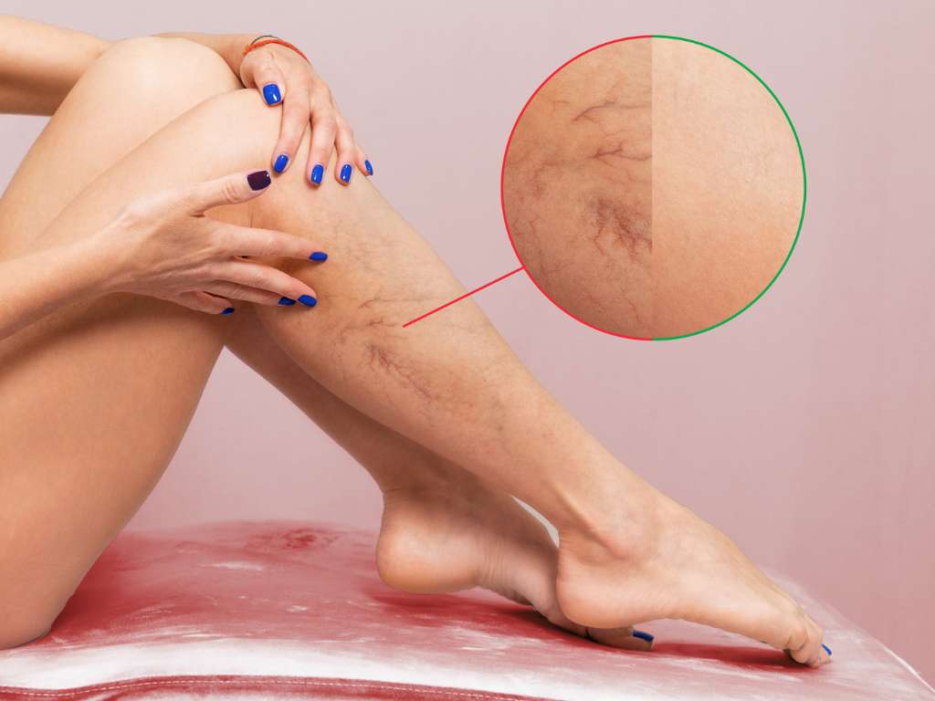 slides tv (Apresentação (43)) (22)