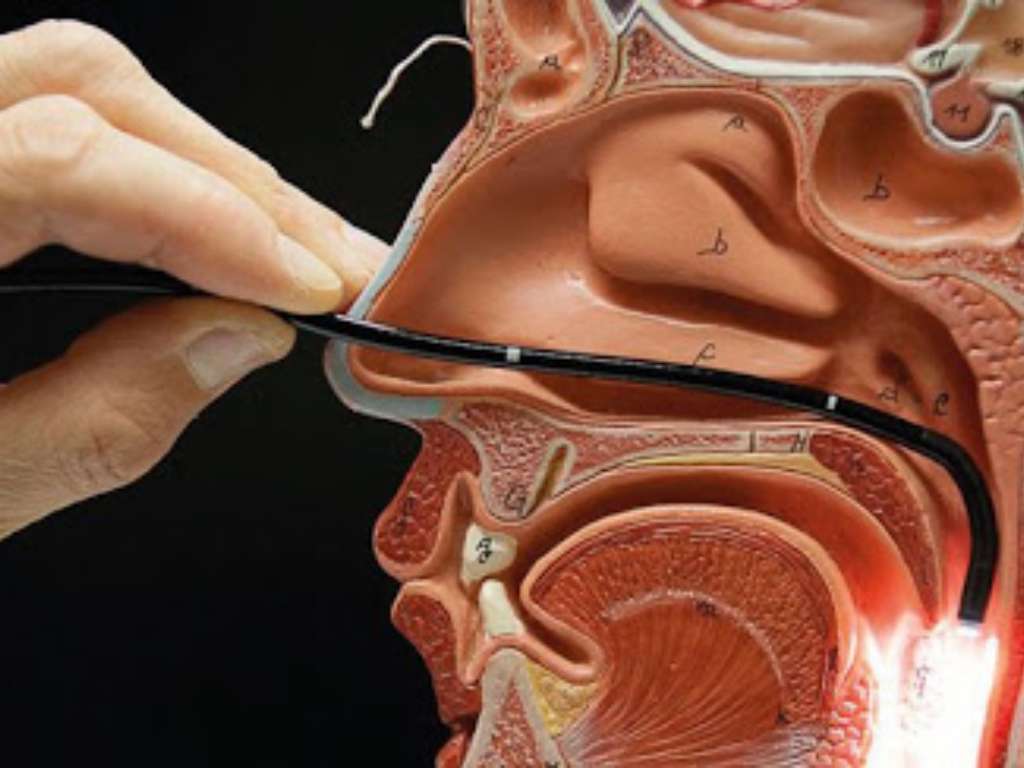 slides tv (Apresentação (43)) (28)