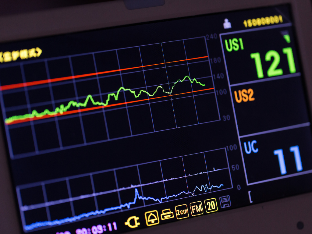 Eletrocardiograma